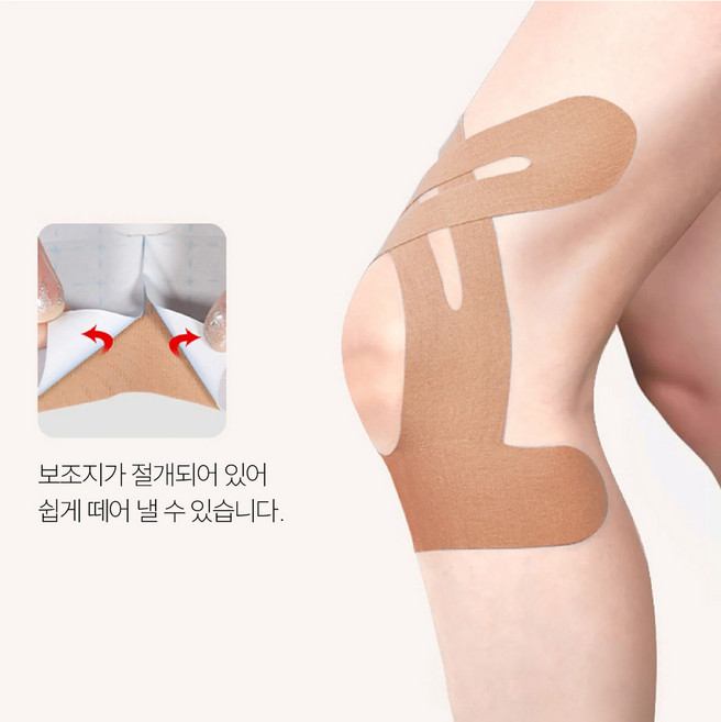 무릎테이핑 장경인대 슬개골 러닝 마라톤대회 준비물 등산 바깥쪽 안쪽 통증 스킨 색상, 1세트, 10개입