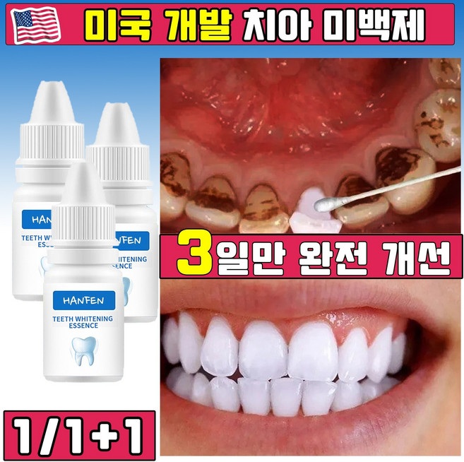 [3일 개선] 미국 미백 치약 누렁이 미백 치약 화이트닝 입 냄세 제거 얼룩 제거 커피 치아 미백 셀프 치아미백 구취 구석 제거 강력 미백 효과보장, 1개, 10ml