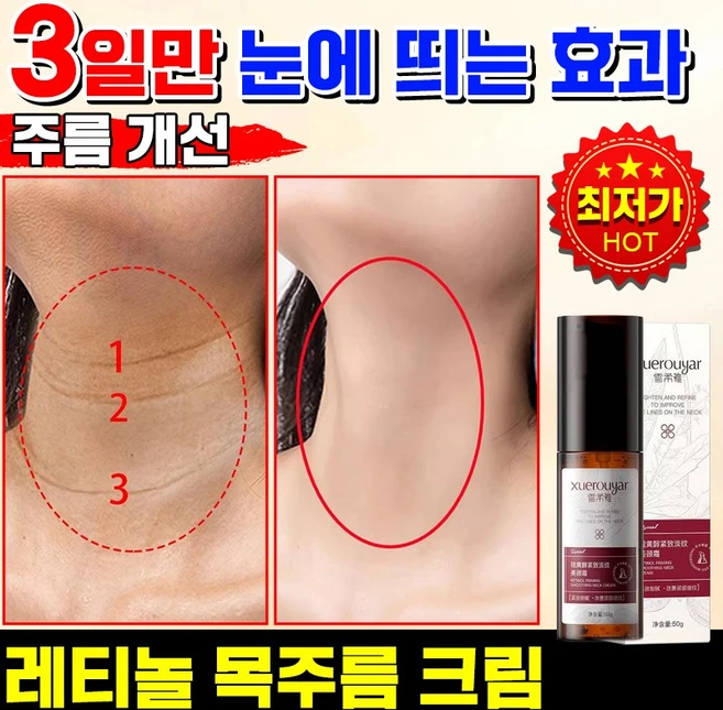 [일본 기술] 레티놀 리프팅 목주름 크림 저분자 히알루론산 넥케어 넥크림 주름 제거 크림 탄력 비타민E 미백 보습 크림, 1개, 50g - 쿠팡