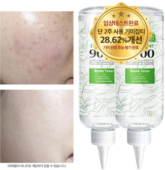 나이아신아마이드 토너 비타민 티트리 미백 기미 잡티 색소침착 착색 수분 보습 모공, 1.티트리폭탄 무알콜토너 500ml 대용량 1개, 2개, 500ml