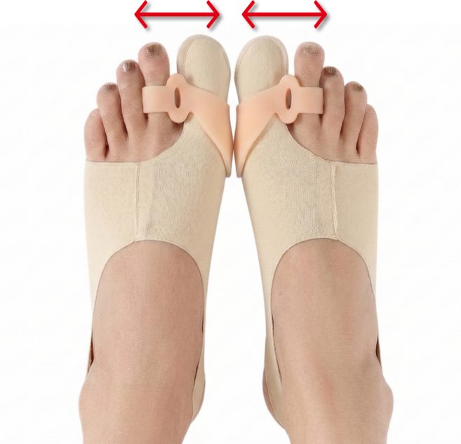 리즈앤모어 엄지발가락 분리 양발보호대 스킨색 + 실리콘링, 1개