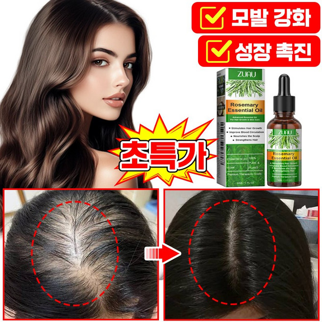 [빠른배송] 로즈마리 오일 100% 탈모 두피 앰플 영양제 두피에센스 탈모 예방 머리 성장 촉진 모발 활력 증진 모낭 영양 포장 증정, 1개, 30ml