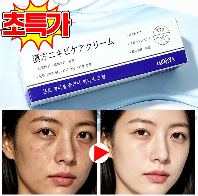 [당일배송] 기미 주근깨 제거 크림 책소침착 멜라논크림 기미 잡티 제거 검버섯 크림 LUPEIYA 신제품, 1개, 30ml