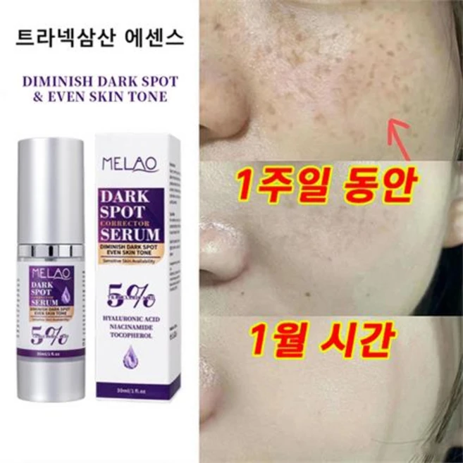 트라넥삼산 크림 트라넥삼산 에센스 미백 기미 제거 세월 흔적 지우기, 2개, 30ml - 쿠팡