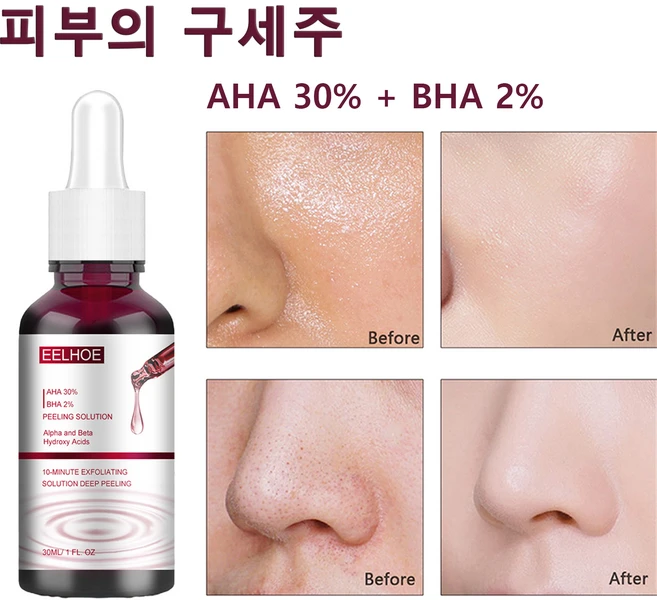 블랙헤드 여드름 각질 제거 살리실산 세럼 데일리 피부관리, 1개, 30ml - 쿠팡