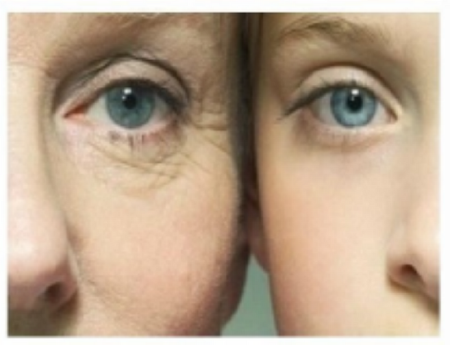 인체제대혈세포 배양액 50000pp 함유 에스알 포미 리필앰플 6ml *40EA, 1개, 240ml