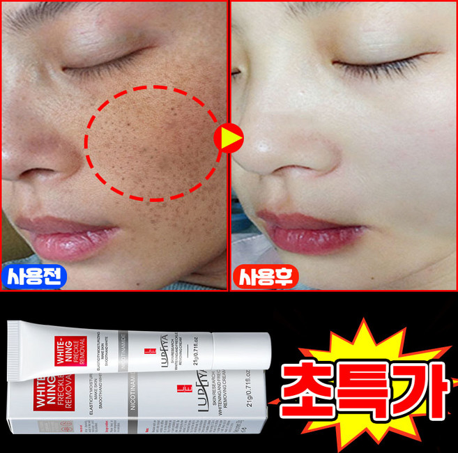 [100% 효과있음] 멜라논 크림 기미크림 기미 잡티 주근깨 검버섯 제거 크림 착색 미백 크림 들깨기미크림 색소침착 화이트닝 LUPEIYA 포장증정, 1개, 21g