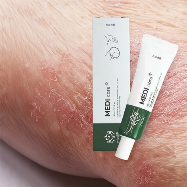 건조한 피부 가려움증 모낭염 피부곰팡이균 습진 땀띠 연고 피부개선 크림, 스킨케어 메디 케어 플러스 건조한 피부 가려움증 간지러, 1개 - 쿠팡