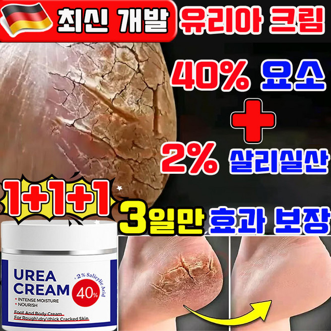 유리아 크림 유리아 풋크림 함익병 유레아 크림 피부연화제 유리아크림 함익병 유레아 크림 뒷꿈치 고보습 유레아 크림 100% 발바닥 각질제거 크림 사은품 랜덤 증정, 3개, 100g