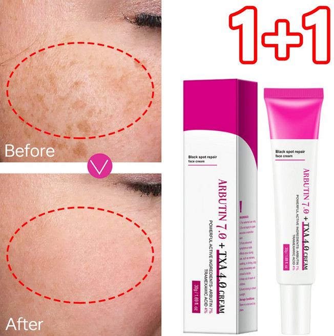 1+1 함익병기미 잡티 제거 크림1위 검버섯 색소침착 미백 크림, 4개, 30g