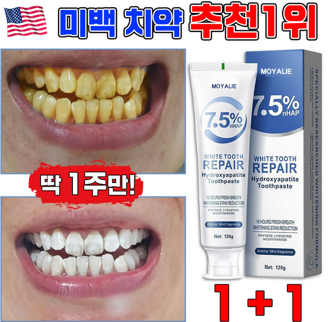 [TV홈쇼핑] 미백 치약 추천1위 미백치약 누렁니 미백 치약 치아미백 화이트닝 치약 입냄새제거 구취제거 치아미백 포장증정 LUPEIYA, 120g, 2개