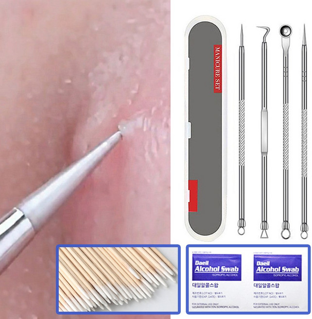 어반온 여드름 피지 압출기 바늘, 1개, 압출기4종