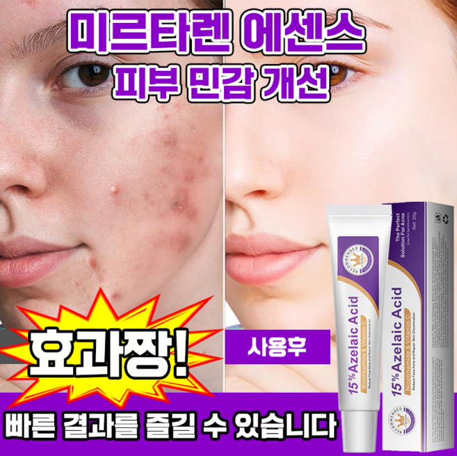 8위 - 함익병 멜라논 크림 동아제약 함익병 기미 잡티 제거 멜라논 크림 착색크림 함익병 동화제약, 1개, 20g
