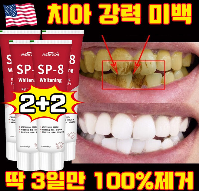 [3일만 효과보장] 1/1+1 미국 SP8 고불소 누렁니 미백치약 구취케어 치약 베이킹소다 효소 화이트닝 치약 입냄새 제거 선물 랜덤 증정, 4세트, 100g