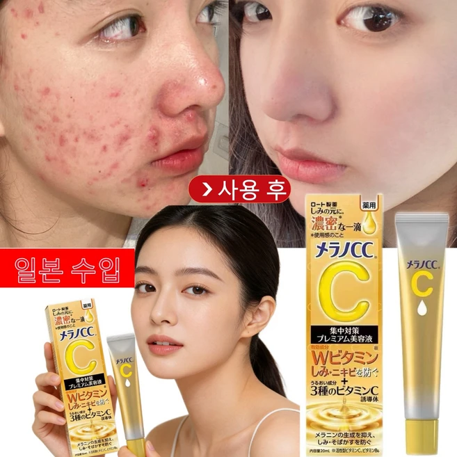 일본의 특허 기술 수입품 3일 여드름 자국 7일간의 페이스 화이트닝 실질적인 효력 VC 에센스 브라이트닝 노른자위 제거 칙칙한 피부톤 개선 임상 검증을 거치다.일본 판매량 1위 화, 4개, 20ml - 쿠팡