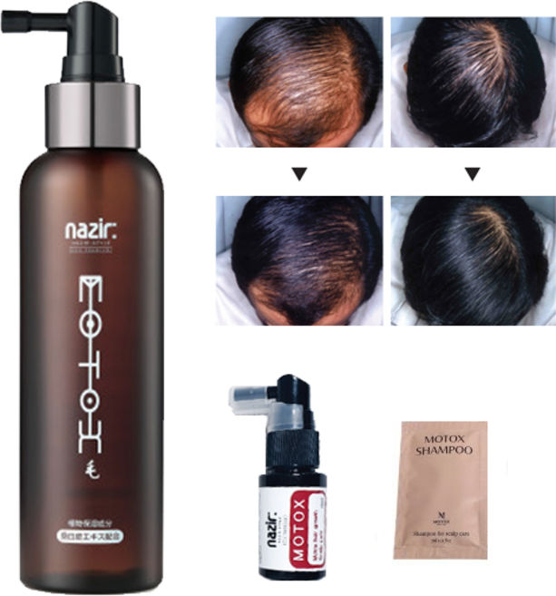 모톡스 3종 에센스 두피젤 샴푸 모발 두피 관리(옵션별 구매), 1개, 500ml