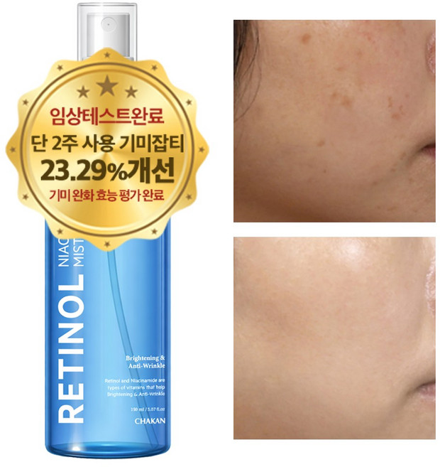 기미 주근깨 색소침착 미백 수분 보습 레티놀 나이아신아마이드 미스트세럼, 1개, 150ml