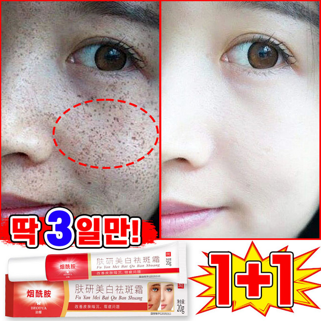 [당일출고] 1/1+1/2+2 기미크림 기미 잡티 검버섯 제거 크림1위 멜라논 크림 착색 미백 크림 들깨기미크림 색소침착 화이트닝 LUPEIYA 포장증정, 2개, 20g