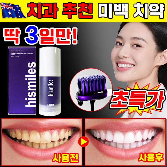 [순간 미백]하이스마일 V34 미백 치약 컬러 코렉터 세럼 화이트닝 누렁니 미백 조색 치약 구취 치석 얼룩 제거 포장 증정, 1개, 30ml