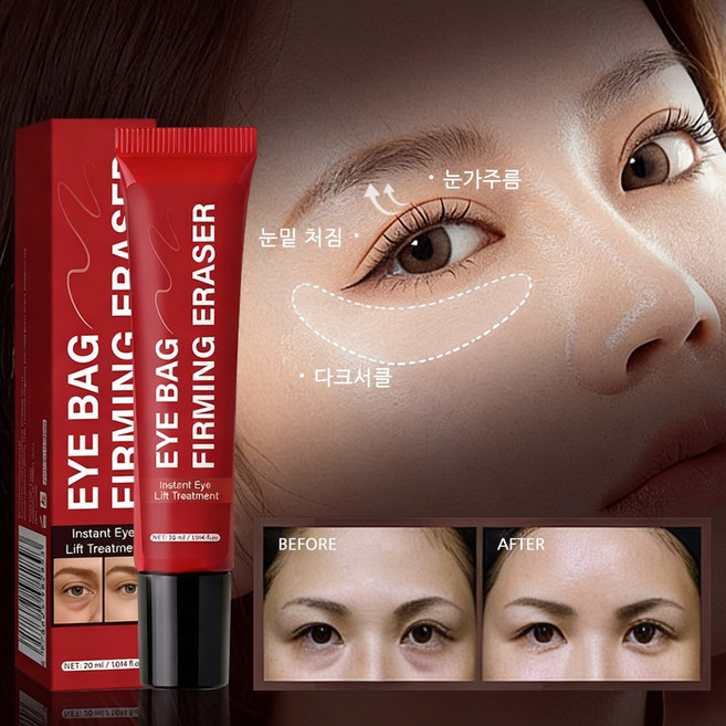 팔자주름 제거 크림1위 눈밑지방크림 아이백 크림 눈밑꺼짐 비립종 제거 연고 비립종 제거 크림 눈 밑 지방 제거 크림 아이크림 눈밑지방 아이백 리프팅 아이크림 눈가주름크림, 3개, 20ml