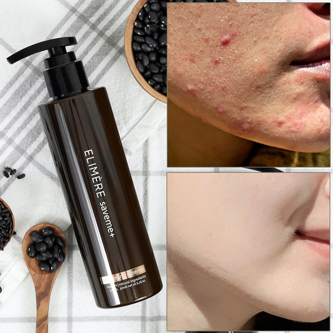세이브미 약산성 블랙헤드 폼클렌징, 1개, 200ml