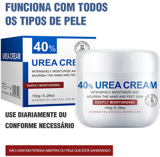 40% 尿素霜 手足深層滋潤乳霜 150g/5.29oz, 1個, 國內銷售，購買等同默認免責聲明）