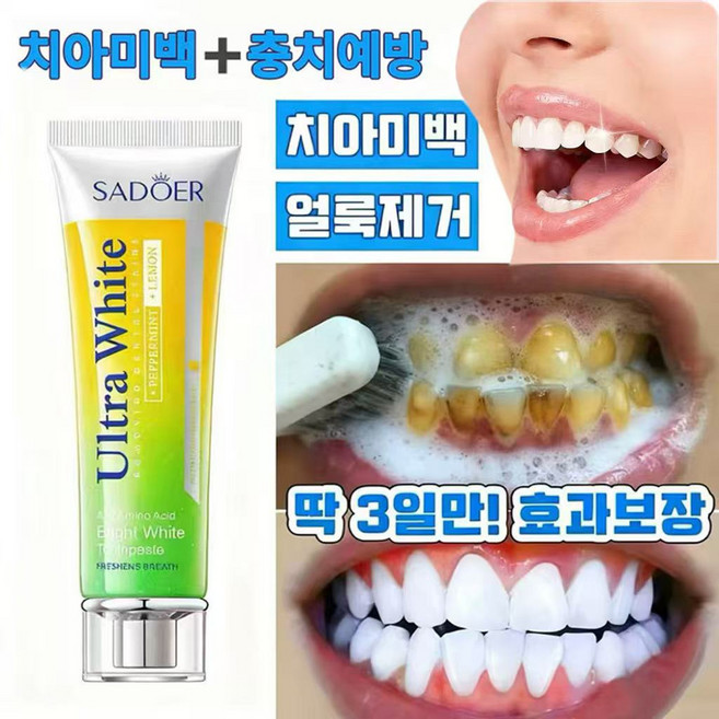 미백치약 치석제거 황치제거 담뱃때제거 충치예방 상큼한 입김 미백 치아 구취 제거 잇몸 민감도 개선, 1개, 1개  100ml