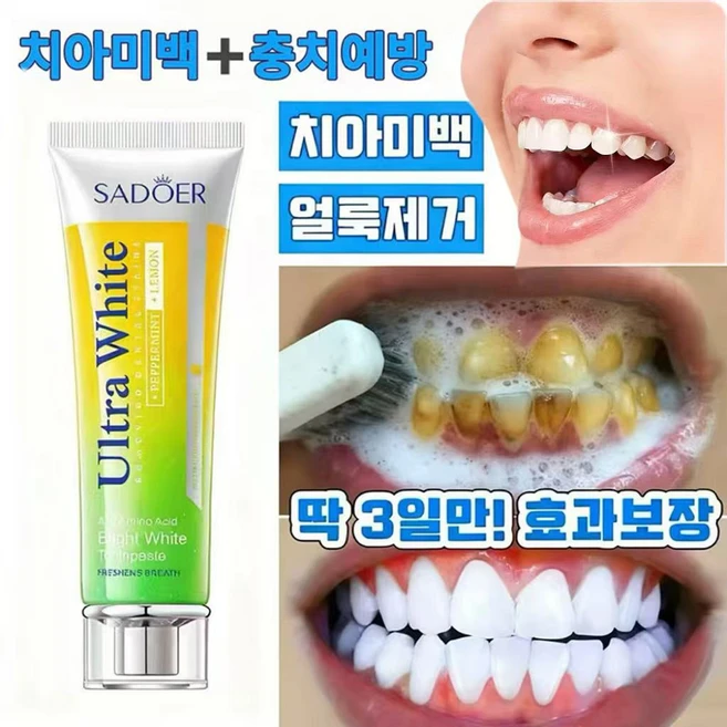 미백치약 치석제거 황치제거 담뱃때제거 충치예방 상큼한 입김 미백 치아 구취 제거 잇몸 민감도 개선, 1개, 1개  100ml - 쿠팡