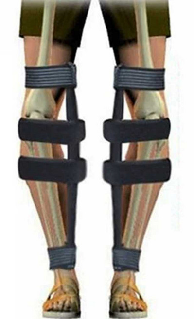 안짱 휜 다리 교정기 체형 종아리 밴드 오자다리 벨트, 1개