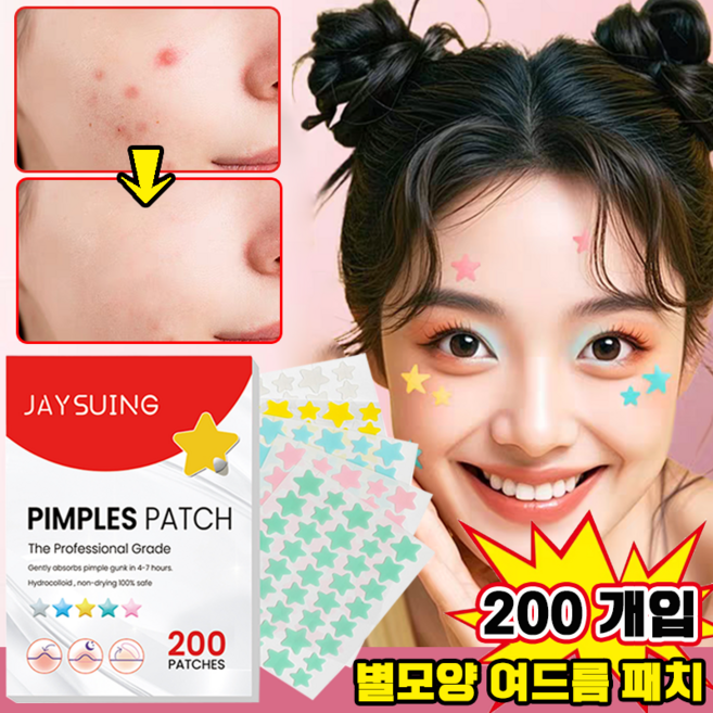 [당일출고] 별모양 여드름 패치 별 귀여운 여드름 패치 스타페이스 트러블 스팟 패치 뾰루지 패치 보장증정, 1개, 198개입