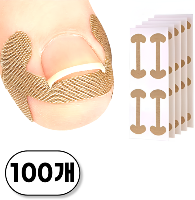 토베루 내성발톱 테이프 밴드, 100개