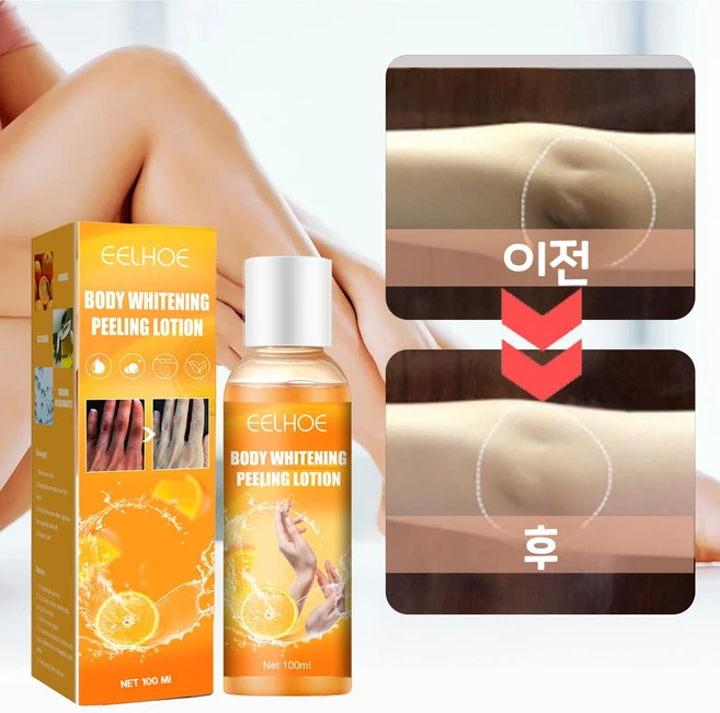 겨드랑이 색소침착 바디 미백 각질 제거, 100ml, 1개 - 쿠팡
