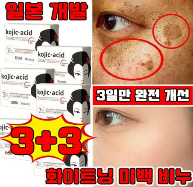[단 3일만에] 1+1/2+2 코직산 화이트닝 미백 비누 전신 미백 세안 바디 페이셜 바디 화이트닝 비누 미용 보습 뽀얀 사은품 랜덤 증정, 6개입, 100g
