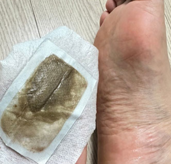 종아리근육뭉침파스 발바닥열감 족저근막염파스 발독소 발바닥파스 발패치 발파스, 10개, 릴렉스