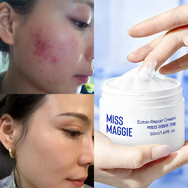 미스매기 EGF 자생크림 피부장벽 진정 민감케어 리페어 크림, 1개, 50ml