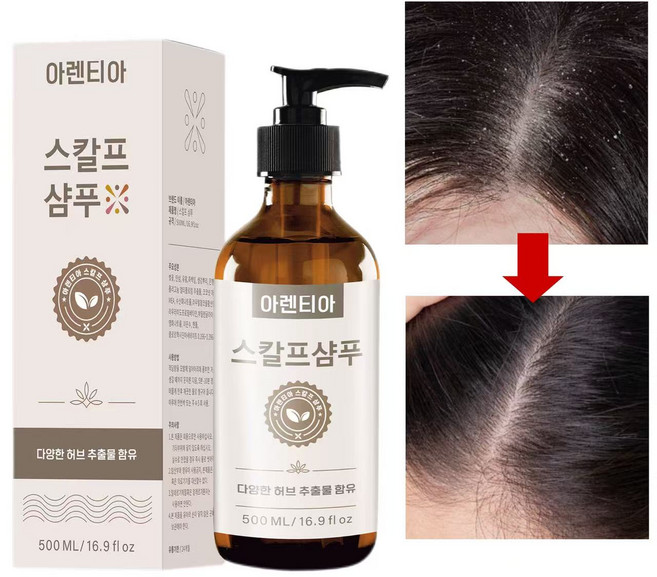 지루성 두피염 샴푸 여성 샴푸 1 위 향기좋은샴푸 비듬 샴푸 비듬균 제거 두피 가려움 개선 약산성 샴푸 손상모 샴푸 여자 남자 비듬샴푸 1위 남자 비듬샴푸 1위 두피 스케일링 샴푸, 1개, 500ml