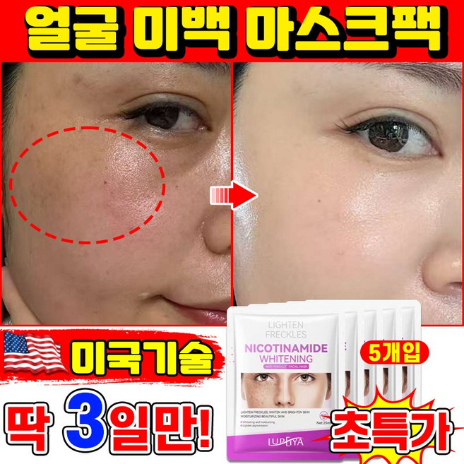 [피부과 추천] 기미 미백 패치 멜라닌 흡착케어 기미삭제마스크 색소침착 기미팩 미백 마스크팩 기미 잡티 주근깨 검버섯 제거 멜라케어 LUPEIYA 포장증정, 1개, 5개입