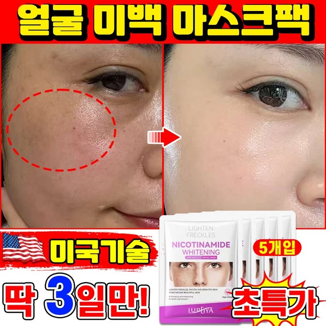 [피부과 추천] 기미 미백 패치 멜라닌 흡착케어 기미삭제마스크 색소침착 기미팩 미백 마스크팩 기미 잡티 주근깨 검버섯 제거 멜라케어 LUPEIYA 포장증정, 1개, 5개입 - 쿠팡