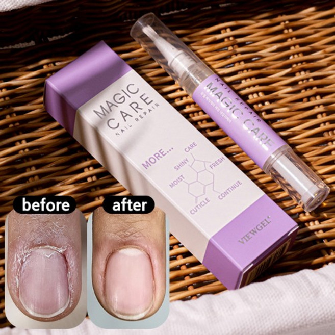 1+1 뷰젤 매직케어 네일세럼 손톱영양제 펜슬 5ml (1개입), 1개