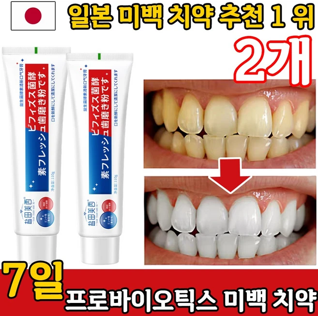 1+1 미백치약 치약 추천 1위 화이트닝 치약 톤업 치석/치석제거 치약, 2개, 110ml - 쿠팡