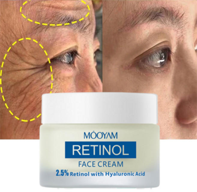 레티놀 크림 주름개선크림 모공수축크림 주름개선 비타민 A 크림 검버섯 제거, 50g, 1개