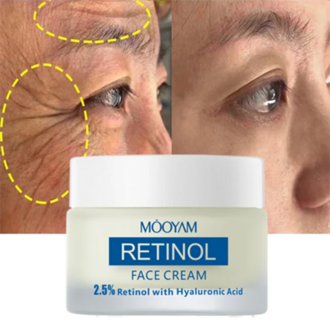 레티놀 크림 주름개선크림 모공수축크림 주름개선 비타민 A 크림 검버섯 제거, 50g, 1개 - 쿠팡