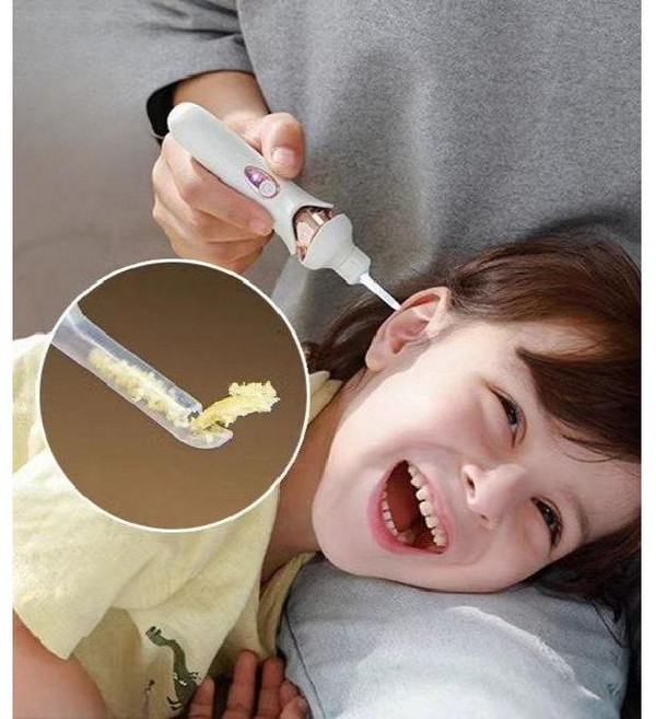 귀지 흡입기 석션기 전동 귀이개 귓밥 클리너 LED 진공 내시경, 1개