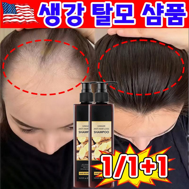 [순수 식물 성분] 1/1+1 탈모 예방 샴푸 비듬 약산성 지루성 두피 손상모 관리 모근 강화 에센스 여성 남자 M자 모발 성장 영양제, 1개, 300ml