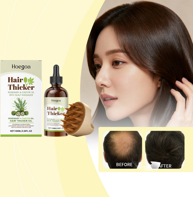 HOEGOA 로즈마리 피마자유 헤어 에센셜 오일 모발 두피케어 헤어브러쉬, 1개, 100ml