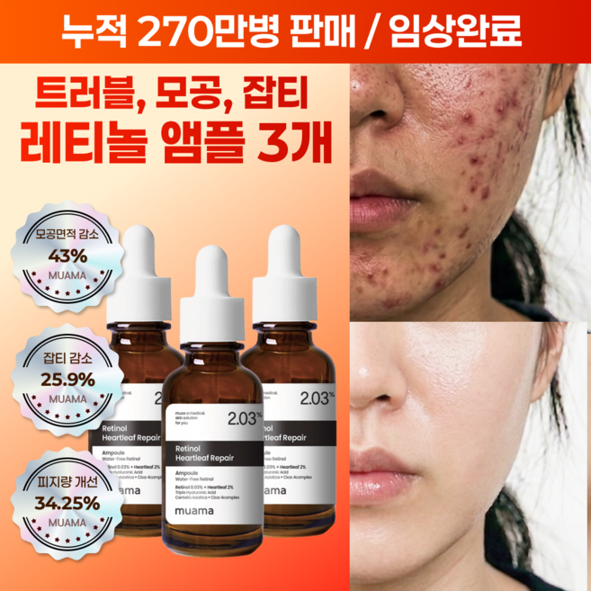 여드름성 피부 사용 적합 사춘기 트러블 진정 개선 모공감소 피지연화 5종 임상완료 [누적 270만병] 고함량 나이아신아마이드 레티놀 어성초 히알루론산 뮤아마 앰플 세럼, 3개, 30ml