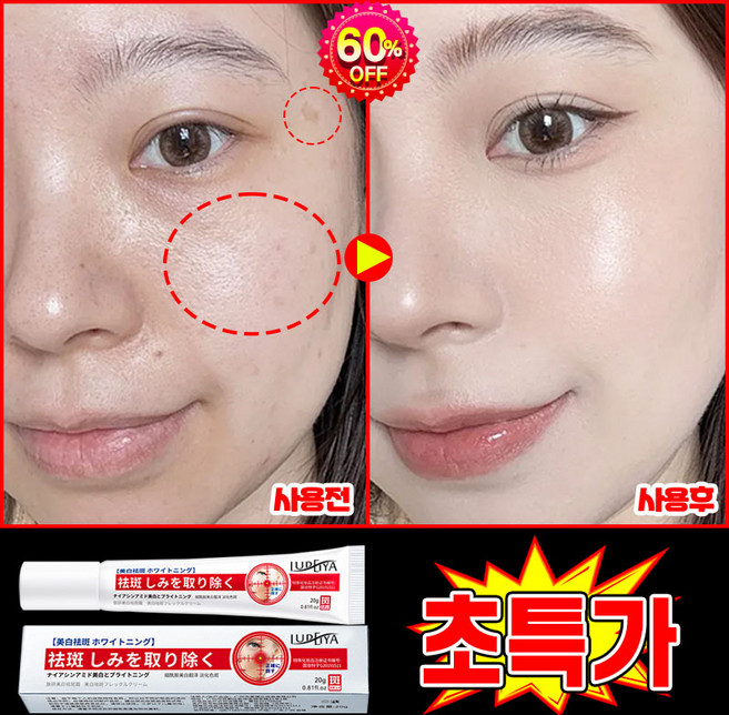 [국내배송] 1/1+1/2+2 멜라논 크림 기미크림 기미 잡티 검버섯 주근깨 제거 크림 미백 착색 크림 색소침착 화이트닝 LUPEIYA 사은품 랜덤 증정, 1개, 20g