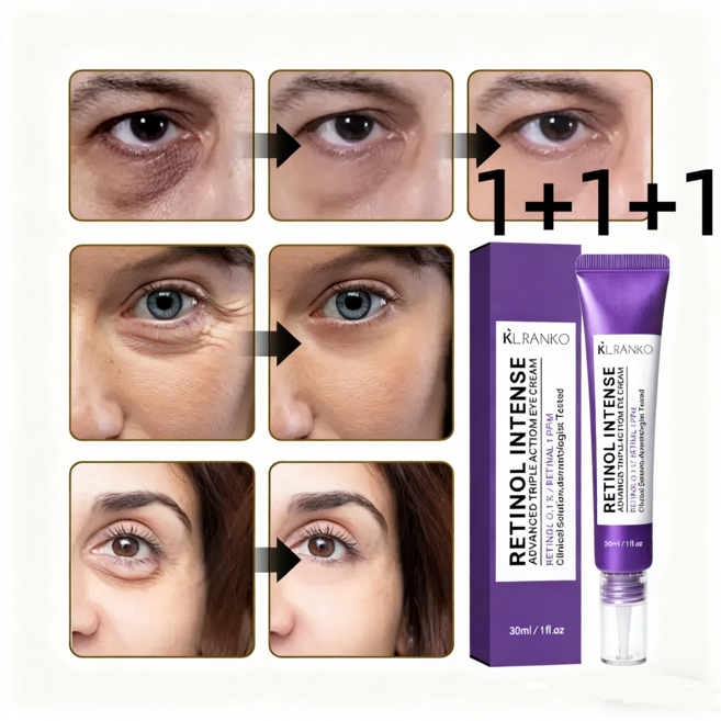 아이백 리프트 1100샷 리들 패치 리프팅 900 아이크림 눈 밑 지방 제거 크림 눈밑지방 아이백, 3개, 30g