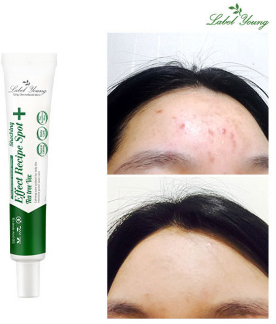 라벨영 쇼킹효과레시피 티트리스팟, 30ml, 1개