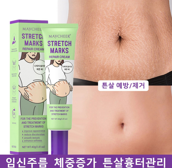 CAICHEN 튼살제거 임산부 전용 출산 후 뱃살 탱탱 튼살 완화 크림 흉터 비만 주름 탄력 케어 크림 바디케어, 1개, 40g
